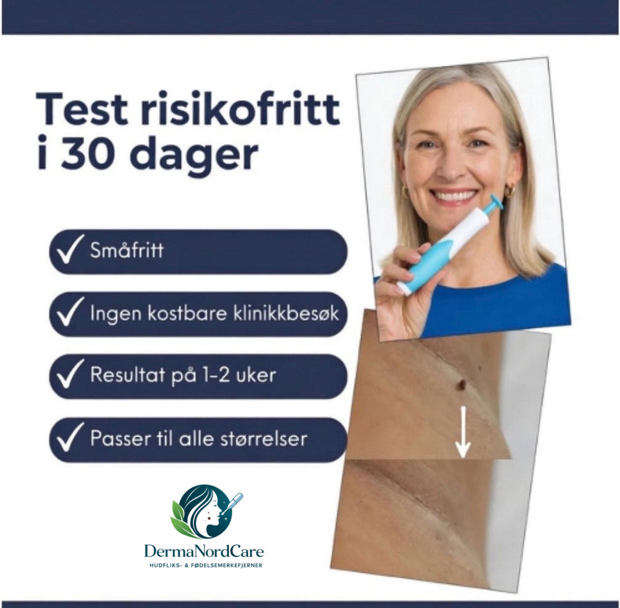 Hudflikfjerner - Slutt å skamme deg over hudflikene dine